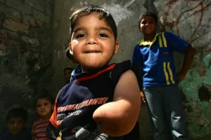 Czteroletni Palestyńczyk Ahmad Sahlol stracił część ręki, gdy izraelski czołg ostrzelał jego dom rodzinny. Fot. Abid Katib/Getty Images