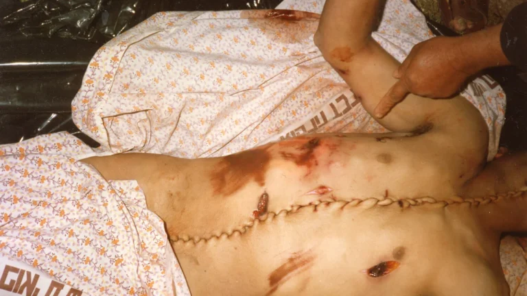 Zdjęcie archiwalne z maja 1992 roku. Bilal Achmed Ghanem (na zdjęciu jego ciało) z miejscowości Imatin na północnym Zachodnim Brzegu został ranny od strzałów izraelskich żołnierzy, a następnie przewieziony wojskowym pojazdem do Abu Kabir Forensic Institute w Tel Awiwie. Po pięciu dniach został zwrócony w środku nocy do swojej wioski — martwy i rozcięty.
