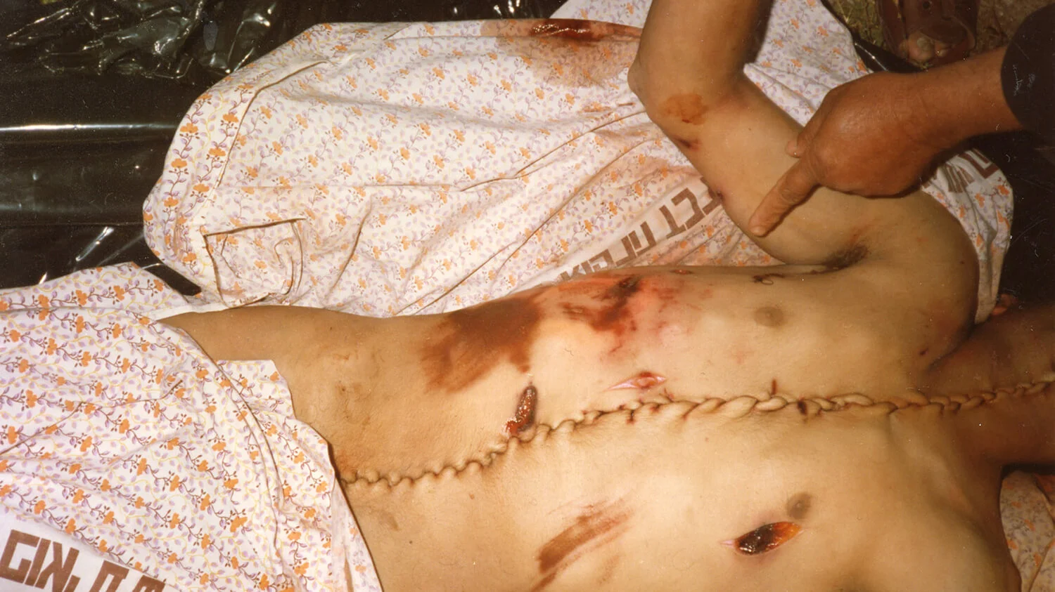 Zdjęcie archiwalne z maja 1992 roku. Bilal Achmed Ghanem (na zdjęciu jego ciało) z miejscowości Imatin na północnym Zachodnim Brzegu został ranny od strzałów izraelskich żołnierzy, a następnie przewieziony wojskowym pojazdem do Abu Kabir Forensic Institute w Tel Awiwie. Po pięciu dniach został zwrócony w środku nocy do swojej wioski — martwy i rozcięty.
